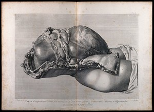 view Dissection of the pregnant female abdomen, showing the skin peeled away to reveal the swollen uterus and the viscera, side view. Copperplate engraving by G. Scotin after I.V. Rymsdyk, 1774, reprinted 1851.