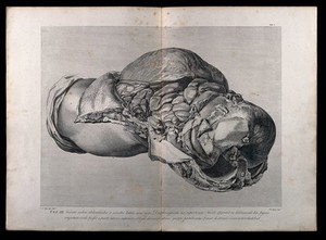 view Dissection of the pregnant female abdomen, showing the skin peeled away to reveal the swollen uterus, the diaphragm and the intestines, side view. Copperplate engraving by T. Major after I.V. Rymsdyk, 1774, reprinted 1851.