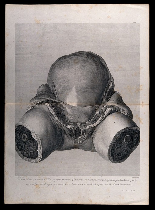 Front view of the pregnant uterus and pelvic area, showing the skin peeled away to reveal the swollen womb. Copperplate engraving by R. Strange after I.V. Rymsdyk, 1774, reprinted 1851.
