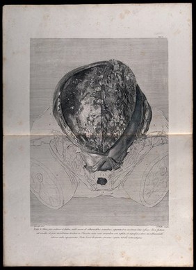 Dissection of the pregnant uterus: initial view of the opened womb. Copperplate engraving by J.S.(?) Müller after I.V. Rymsdyk, 1774, reprinted 1851.