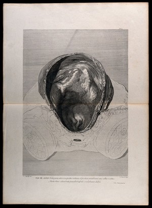 view Front view of the cavity of the uterus, after the removal of a foetus: the investing membranes still adhering. Engraving by F.S. Ravenet after I.V. Rymsdyk, 1774, reprinted 1851.