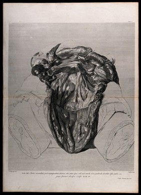 Dissection made after the removal of a pregnant uterus, showing the parts lying immediately behind. Copperplate engraving by C. Grignion after I.V. Rymsdyk, 1774, reprinted 1851.