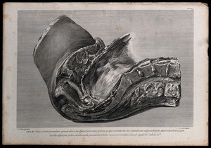 view Section through the pelvis of a pregnant woman, showing the spine and part of the uterus: side view. Copperplate engraving by G. Scotin after I.V. Rymsdyk, 1774, reprinted 1851.