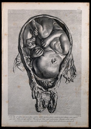 view Dissection of a pregnant uterus, showing the foetus at nine months, with the head positioned towards the vagina and the lower part of the placenta under the child's head, detached from the uterus. Copperplate engraving by J. Mitchel after I.V. Rymsdyk, 1774, reprinted 1851.