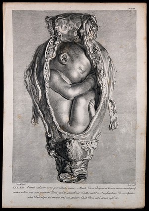 view Dissection of a pregnant uterus, showing the foetus at nine months, with its head facing upwards. Copperplate engraving by Mechel after I.V. Rymsdyk, 1774, reprinted 1851.