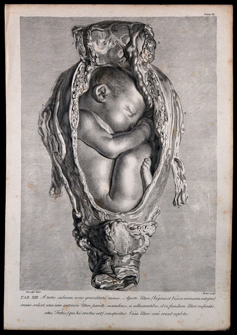 Dissection of a pregnant uterus, showing the foetus at nine months, with its head facing upwards. Copperplate engraving by Mechel after I.V. Rymsdyk, 1774, reprinted 1851., [1851], by Jan van Rymsdyk