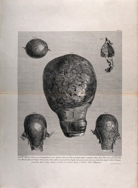 Five figures showing the arterial system of the uterus during pregnancy. Copperplate engraving by F. Aliamet after I.V. Rymsdyk, 1774, reprinted 1851.