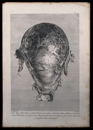 Dissection of the pregnant uterus at eight months, showing the distribution of the larger uterine vessels. Copperplate engraving by Menil after I.V. Rymsdyk, 1774, reprinted 1851.