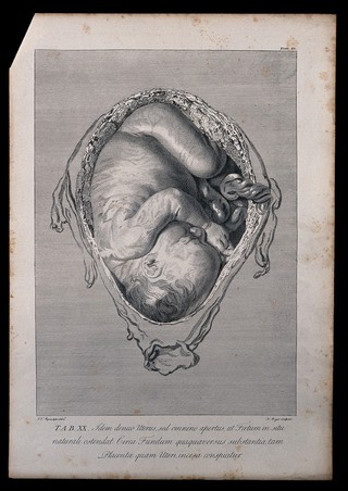 Dissection of the pregnant uterus, showing the foetus at eight months, with the head positioned towards the vagina. Copperplate engraving by J.C. Bryer after I.V. Rymsdyk, 1774, reprinted 1851.