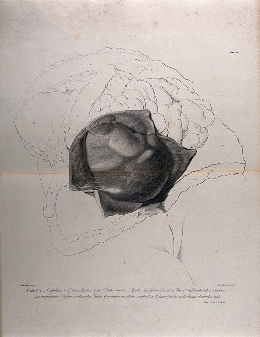 Dissection of the female abdomen, showing part of the pregnant uterus at seven months, with the surrounding viscera. Copperplate engraving by F. Aliamet after A. Cozens, 1774, reprinted 1851.