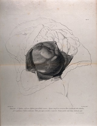 Dissection of the female abdomen, showing part of the pregnant uterus at seven months, with the surrounding viscera. Copperplate engraving by F. Aliamet after A. Cozens, 1774, reprinted 1851.