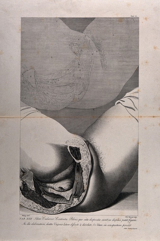 Dissection of the female pelvis, showing part of the rectum and genital area, with an outline diagram above. Copperplate engraving by F. Aliamet after Blakey, 1774, reprinted 1851.