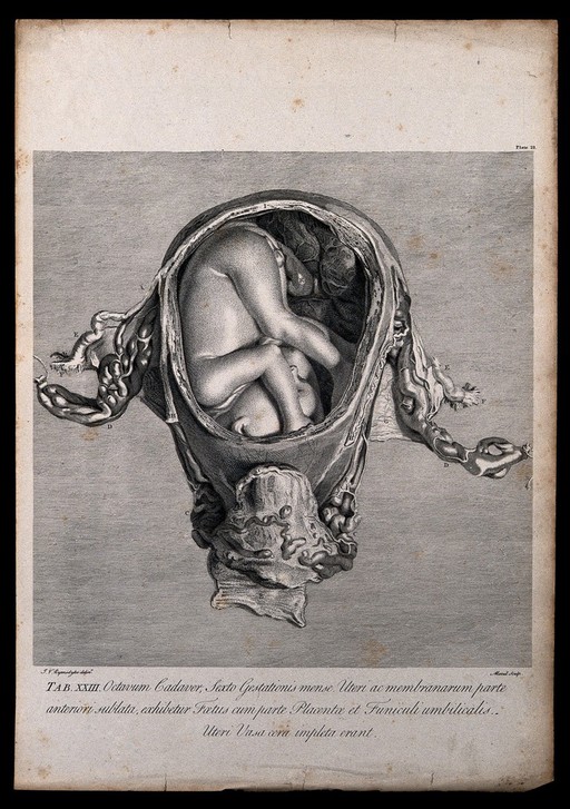 Dissection of the pregnant uterus, showing the foetus at six months. Copperplate engraving by Menil after J.V. Rymsdyk, 1774, reprinted 1851.