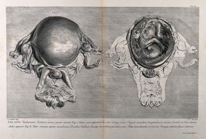 view Dissections of the pregnant uterus at five months: two figures. Copperplate engraving by P.C. Canot after J.V. Rymsdyk, 1774, reprinted 1851.