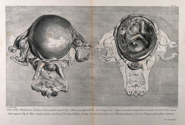 Dissections of the pregnant uterus at five months: two figures. Copperplate engraving by P.C. Canot after J.V. Rymsdyk, 1774, reprinted 1851.