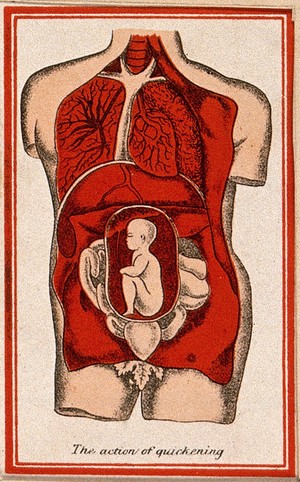 view Dissection of the torso of a pregnant woman. Colour lithograph, 1850/1910?.