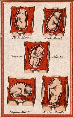 view Development of the foetus in the uterus: five figures, from the fifth to the ninth month of gestation. Colour lithograph, 1850/1910?.