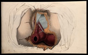 view The female reproductive system: dissection of the genitalia and anus. Coloured line engraving by W.H. Lizars, ca. 1827.