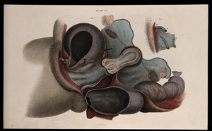 view The female reproductive system: dissection showing the uterus, ovaries and fallopian tubes, the intestines and bladder, with a detail showing the clitoris. Coloured line engraving by W.H. Lizars, ca. 1827.