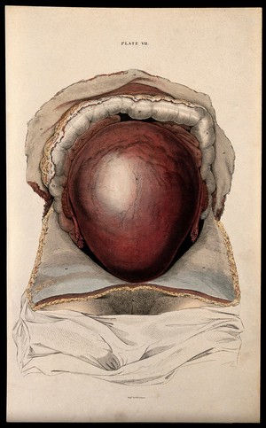 view Dissection showing the pregnant uterus. Coloured line engraving by W.H. Lizars, ca. 1827.