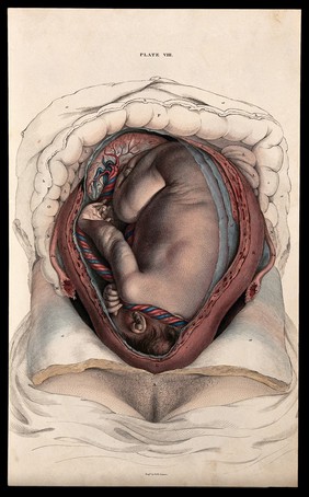 Dissection of the uterus in the latter stages of pregnancy, showing the foetus, placenta and umbilical cord. Coloured line engraving by W.H. Lizars, ca. 1827.