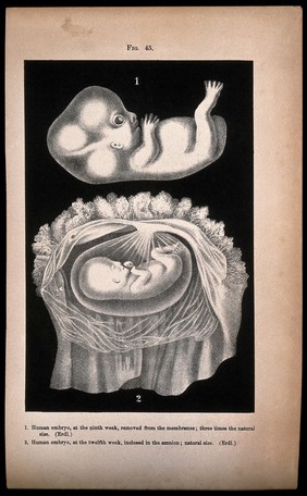 Human embryo, two figures: above, the foetus at nine weeks, below, the foetus at twelve weeks, shown enclosed in the amnion. Lithograph after Erdl, 1850/1900?.