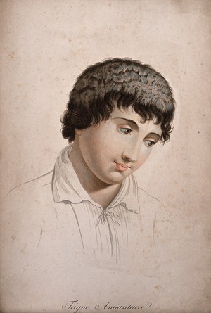 view Head of a man with skin disease. Coloured stipple engraving by S. Tresca after Moreau-Valvile, c. 1806.