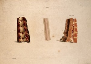 view Three sections of vertebrae. Coloured aquatint by Bennett after J. Harrison, c. 1820.