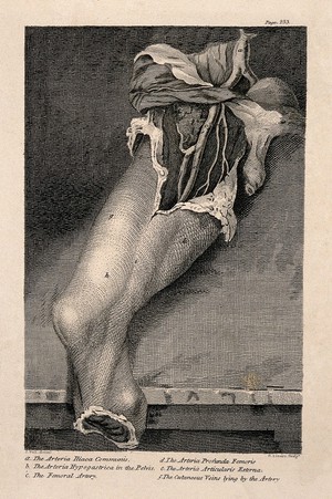 view An amputated leg with dissected thigh, lettered for key. Etching by D. Lizars after J. Bell, c. 1810 (?).