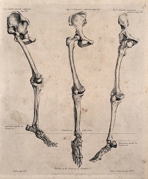 view Three skeletal legs with pelvis and foot attached. Etching by J. Bell, c. 1810 (?).