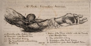 view A dissected arm showing arteries, numbered for key. Etching by J. Bell, ca. 1815.
