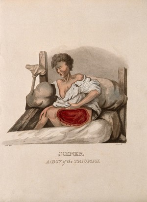 view A boy with a wounded thigh seated on a bed; a crutch to his right. Coloured stipple etching by J. Grant after J. Bell, ca. 1815.