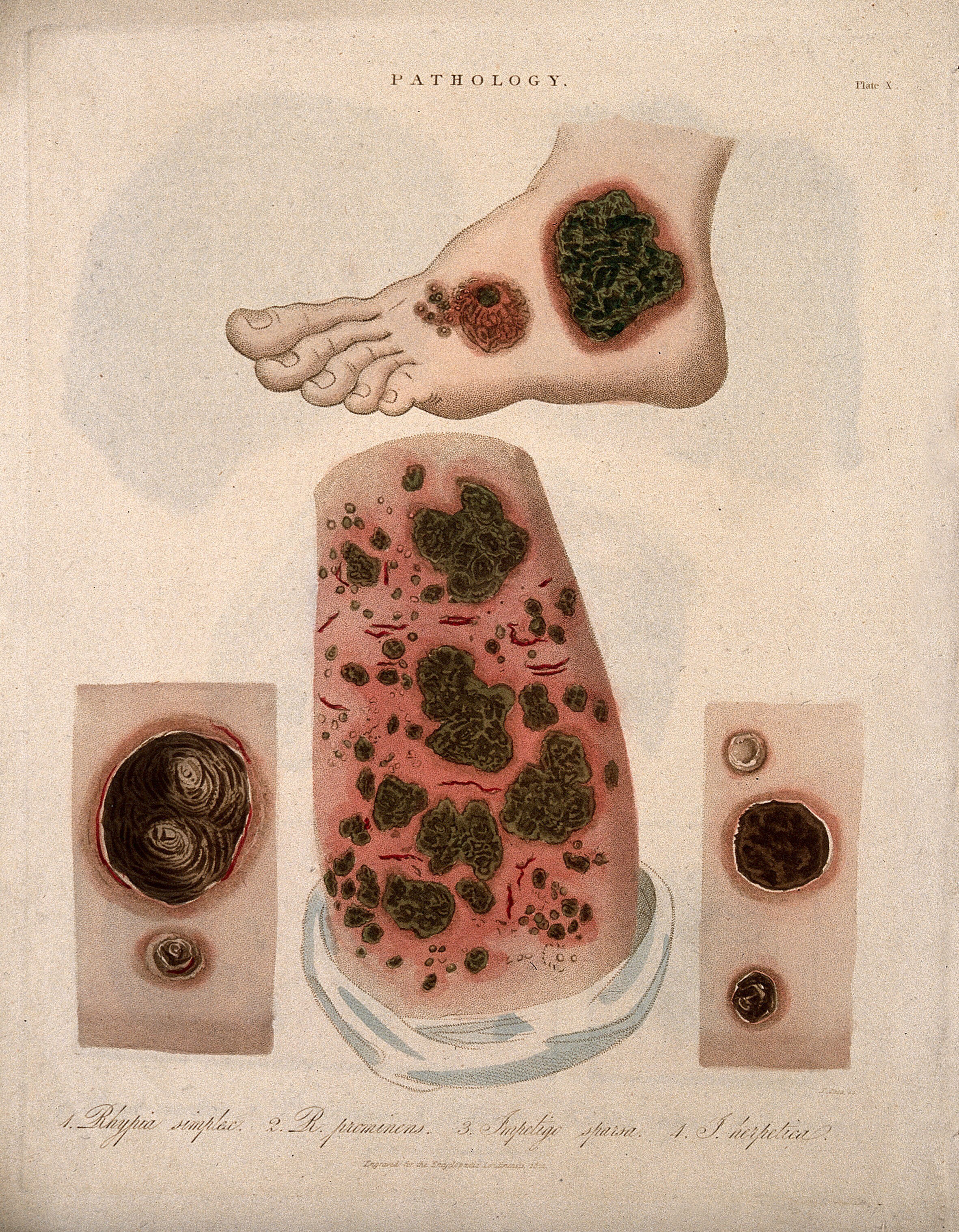 Types of outlet skin diseases