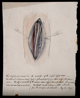 A dissected arm. Watercolour, 1829.