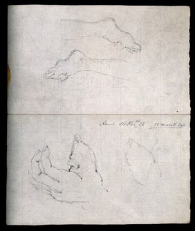 Four sketches of foot and hand deformities, showing swellings of the thumb and on the top of the foot. Drawing, c. 1818 (watermark).