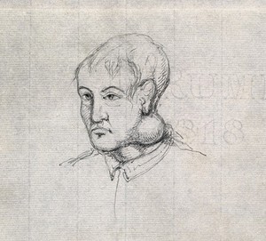 view The head and shoulders of a young man, seen in 3/4 profile, with a large swelling on his neck. Drawing, c. 1818 (watermark).