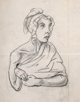 A woman with a deformed right hand and forearm. Drawing, c. 1825 (watermark).