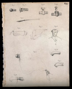 Several sketches of piping and apparatus; an eyepatch and sling, and a man wearing a similar patch, numbered for key. Drawing.