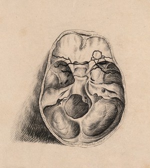 view A cross-section through a skull revealing the cavities within. Charcoal drawing.