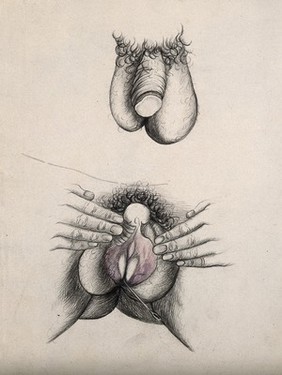 A penis and scrotum; and labia held open by hand with a rod (?) extending from the vagina. Coloured drawing.