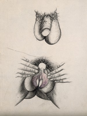 view A penis and scrotum; and labia held open by hand with a rod (?) extending from the vagina. Coloured drawing.