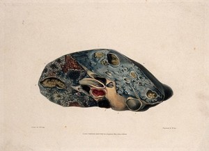 view A diseased lung. Coloured aquatint by W. Say after F. R. Say for Richard Bright, 1827.