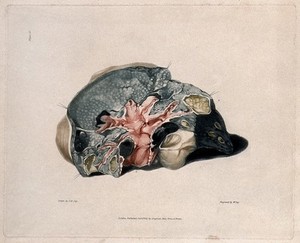 view A diseased lung. Colour aquatint by W. Say after F. R. Say for Richard Bright, 1827.