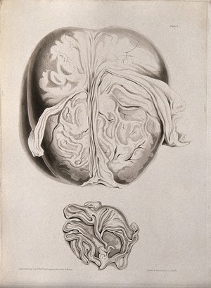 view A dissected brain; and a section of a child's brain. Aquatint by C. J. Canton for Richard Bright, 1829.