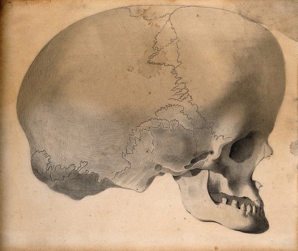 The deformed skull of James Cardinal: profile view. Drawing attributed to G. Scharf, c. 1830.