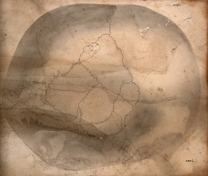 The deformed skull of James Cardinal as viewed from above. Drawing attributed to G. Scharf, c. 1830.