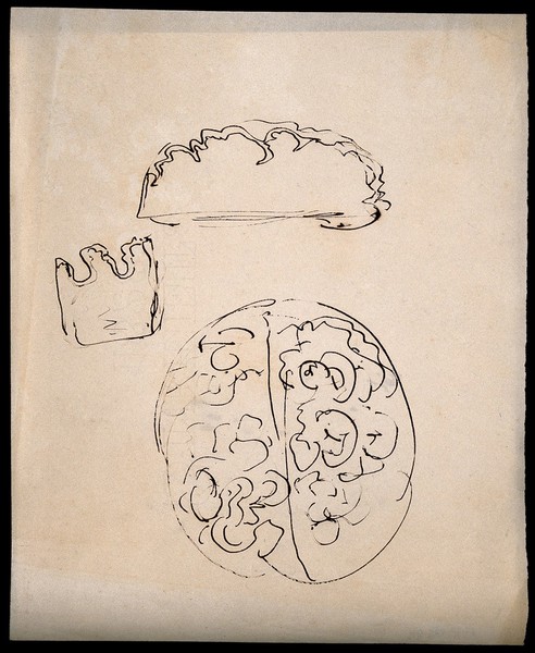 A brain; and two sections of brain (?). Drawing.