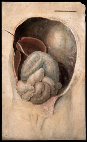 A dissected abdomen with a collection of pus in the cavity. Watercolour, c. 1824.