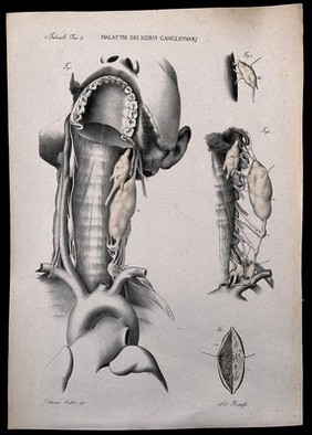 Four examples of diseases of the throat, numbered for key. Lithograph by Ridolfi after Ottavio Muzzi, c. 1843.