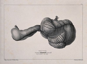 view A diseased part of the body. Lithograph by W. Walton after Franz Bauer.